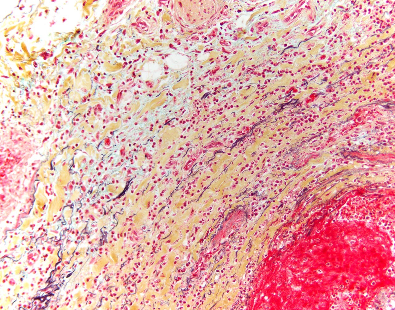 This image shows a cell under a microscope.