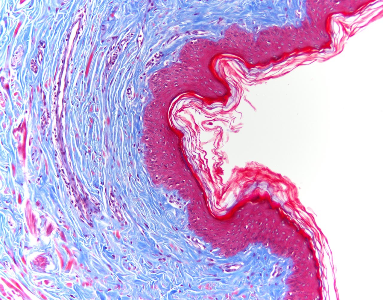 This image shows a cell under a microscope.