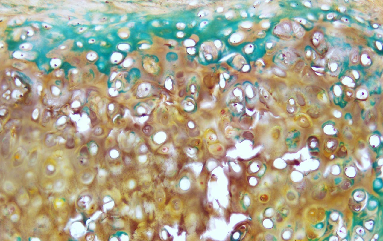 This image shows a cell under a microscope.