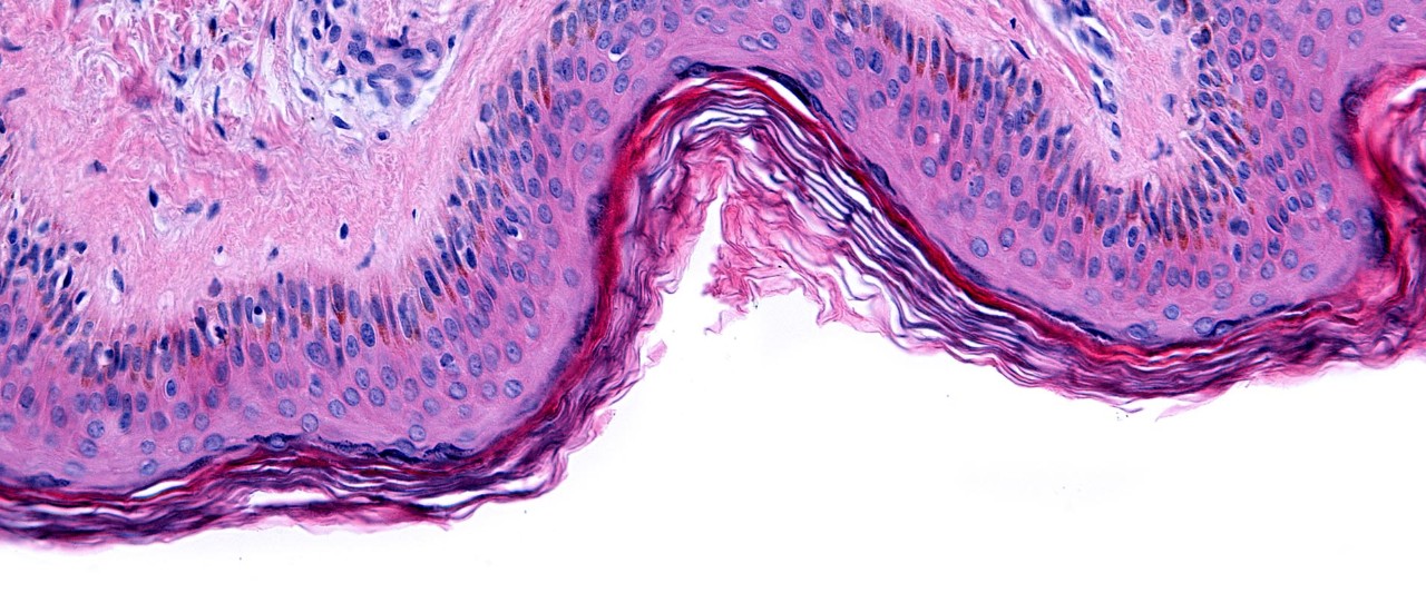 Thin skin showing the epidermis with its different strata, resting on the dermis.